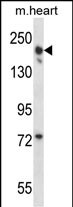 WB - LRRC16B Antibody (C-term) AP14016B