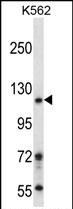 WB - BRD1 Antibody (N-term) AP14018a