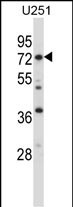 RDX Antibody (C-term) (Cat. #AP14028b) western blot analysis in U251 cell line lysates (35ug/lane).This demonstrates the RDX antibody detected the RDX protein (arrow).