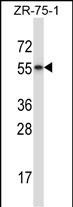 RORB Antibody (C-term) (Cat. #AP14054b) western blot analysis in ZR-75-1 cell line lysates (35ug/lane).This demonstrates the RORB antibody detected the RORB protein (arrow).