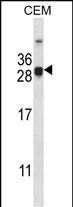 WB - CIDEA Antibody (C-term) AP14057b