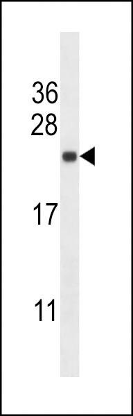 SEC22B Antibody (Center) (Cat. #AP14062c) western blot analysis in Hela cell line lysates (35ug/lane).This demonstrates the SEC22B antibody detected the SEC22B protein (arrow).
