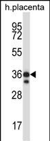 WB - Mouse Mst4 Antibody (Center) AP14072c