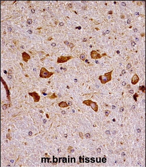 IHC-P - Mouse Pak7 Antibody (N-term) AP14074a