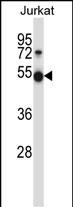 Mouse Pim1 Antibody (C-term) (Cat. #AP14077b) western blot analysis in Jurkat cell line lysates (35ug/lane).This demonstrates the Pim1 antibody detected the Pim1 protein (arrow).