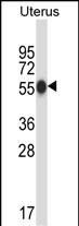 WB - CPO Antibody (N-term) AP14095a