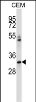 WB - IBSP Antibody (N-term) AP14114a