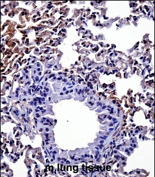 IHC-P - Mouse Hipk4 Antibody (C-term) AP14121B