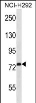WB - RPH3A Antibody (C-term) AP14129b
