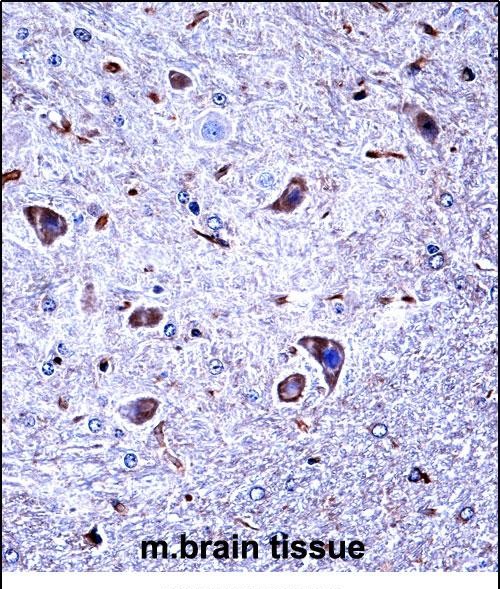 IHC-P - Mouse Csnk1g1 Antibody (C-term) AP14134b