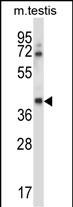 WB - Mouse Csnk1g1 Antibody (C-term) AP14134b