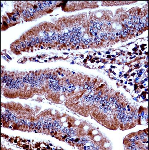 IHC-P - Mouse Prkd3 Antibody (N-term) AP14141A