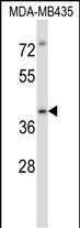 WB - Mouse Irak4 Antibody (C-term) AP14148b