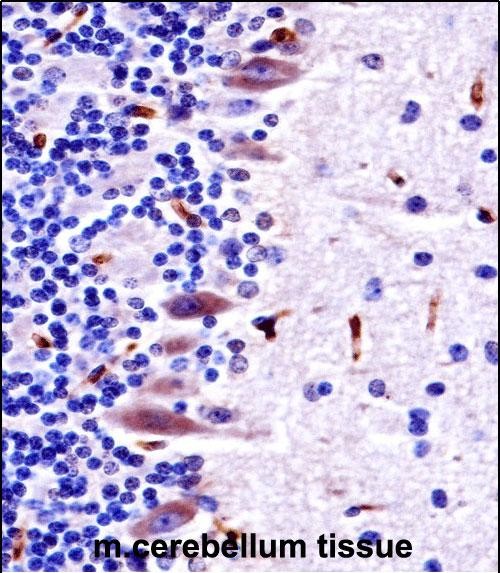 IHC-P - Mouse Mlk4 Antibody (Center) AP14157c