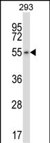 WB - KIAA0895 Antibody (N-term) AP14181a