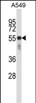 WB - KRT6C Antibody (N-term) AP14194a
