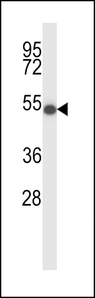 WB - ZDH16 Antibody (C-term) AP14199B