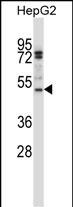 WB - TRIP6 Antibody (N-term) AP14201A