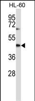 WB - CYTH1 Antibody (N-term) AP14202a