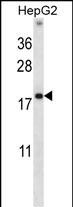 WB - HMGN1 Antibody (N-term) AP14219a