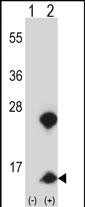 WB - HMGN1 Antibody (N-term) AP14219a