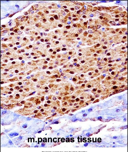 IHC-P - Mouse Scyl3 Antibody (C-term) AP14252b