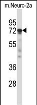 WB - Mouse Prkcz Antibody (N-term) AP14258a