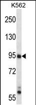 WB - Mouse Map3k10 Antibody (N-term) AP14262a