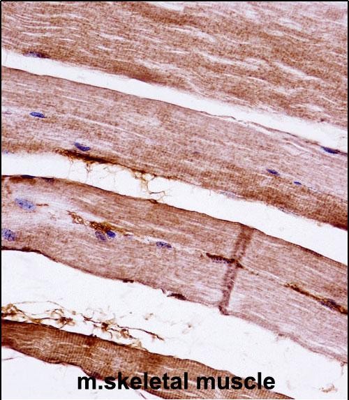 IHC-P - Mouse Mapkapk3 Antibody (N-term) AP14268a