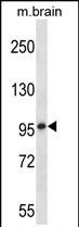 WB - Mouse Mark1 Antibody (C-term) AP14269B