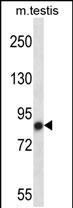 WB - Mouse Nek4 Antibody (N-term) AP14273a
