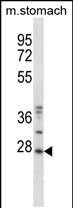 WB - Mouse Tp53rk Antibody (Center) AP14294c