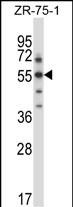 WB - Mouse Sgk3 Antibody (C-term) AP14298b