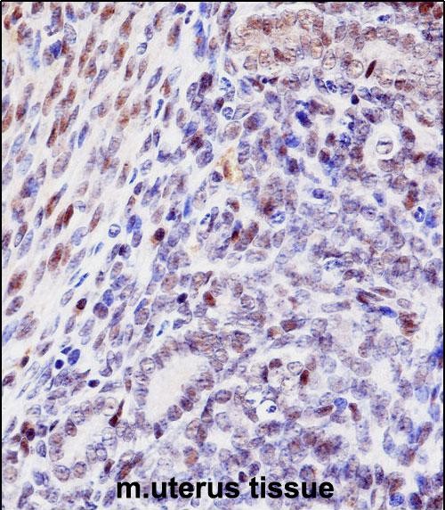 IHC-P - Mouse Hoxd10 Antibody (Center) AP14309C