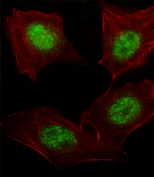 Fluorescent image of A549 cell stained with hARNT-V528(Cat#AP14310c).A549 cells were fixed with 4% PFA (20 min), permeabilized with Triton X-100 (0.1%, 10 min), then incubated with hARNT primary antibody (1:25, 1 h at 37?). For secondary antibody, Alexa Fluor� 488 conjugated donkey anti-rabbit antibody (green) was used (1:400, 50 min at 37?).Cytoplasmic actin was counterstained with Alexa Fluor� 555 (red) conjugated Phalloidin (7units/ml, 1 h at 37?).hARNT immunoreactivity is localized to Nucleus significantly.