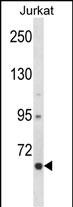 CRTC2 Antibody (N-term) (Cat. #AP14321a) western blot analysis in Jurkat cell line lysates (35ug/lane).This demonstrates the CRTC2 antibody detected the CRTC2 protein (arrow).