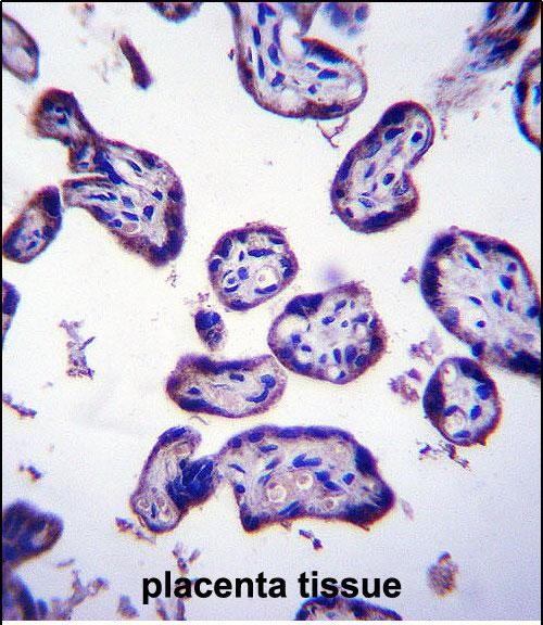 IHC-P - TM4SF18 Antibody (Center) AP14327c