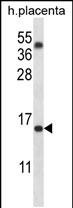 WB - TM4SF18 Antibody (Center) AP14327c