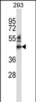 WB - ZNF660 Antibody (C-term) AP14330b