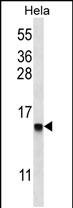 WB - DEFB112 Antibody (N-term) AP14332a