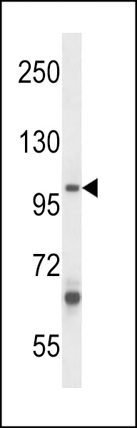 WB - ZC3H12B Antibody (C-term) AP14347b