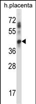 WB - UBE2J1 Antibody (N-term) AP14379a