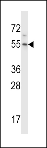 HM13 Antibody (C-term) (Cat. #AP14392b) western blot analysis in Hela cell line lysates (35ug/lane).This demonstrates the HM13 antibody detected the HM13 protein (arrow).