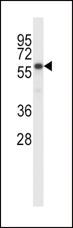 BIRC2 Antibody (Center) (Cat. #AP14418c) western blot analysis in MDA-MB231 cell line lysates (35ug/lane).This demonstrates the BIRC2 antibody detected the BIRC2 protein (arrow).