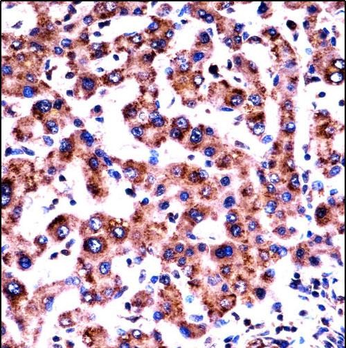 IHC-P - HRH1 Antibody (Center) AP14425c