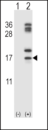 Western blot analysis of CLC (arrow) using rabbit polyclonal CLC Antibody (C-term) (Cat. #AP14439b). 293 cell lysates (2 ug/lane) either nontransfected (Lane 1) or transiently transfected (Lane 2) with the CLC gene.