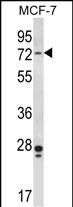 Mouse Pak4 Antibody (Center) (Cat. #AP14453c) western blot analysis in MCF-7 cell line lysates (35ug/lane).This demonstrates the Pak4 antibody detected the Pak4 protein (arrow).