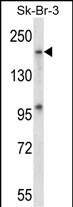 WB - Mouse Map4k4 Antibody (Center) AP14459C