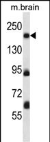 WB - Mouse Map4k4 Antibody (Center) AP14459C
