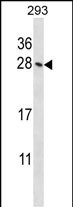 WB - Mouse Hoxb4 Antibody (N-term) AP14465a